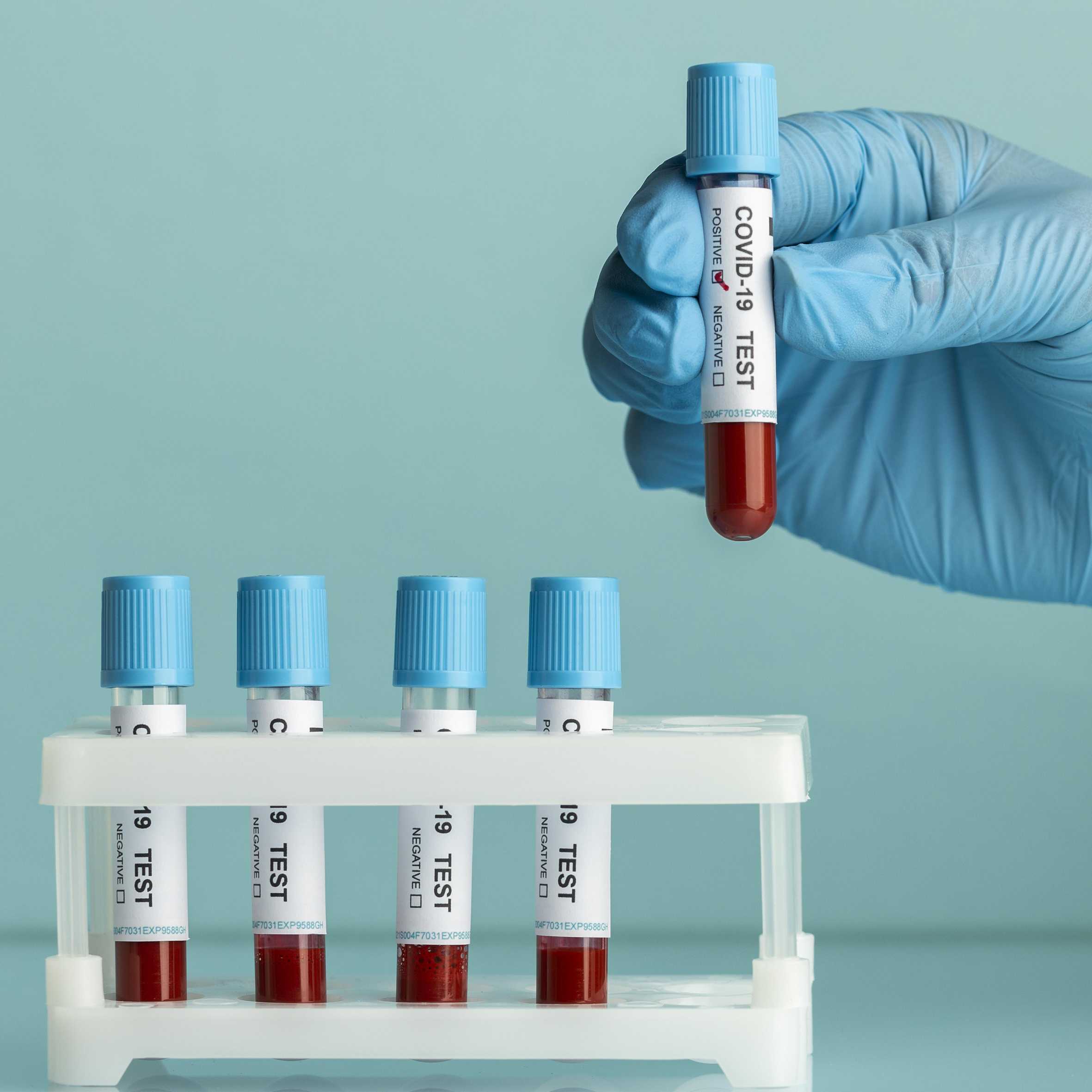 Fabrica de Papéis a Thermo Flexo, trabalha com Revestimento Térmico, Rótulos Especiais, Etiquetas Adesivas, Bobinas de Papel Papéis, Bobinas, Suprimentos,